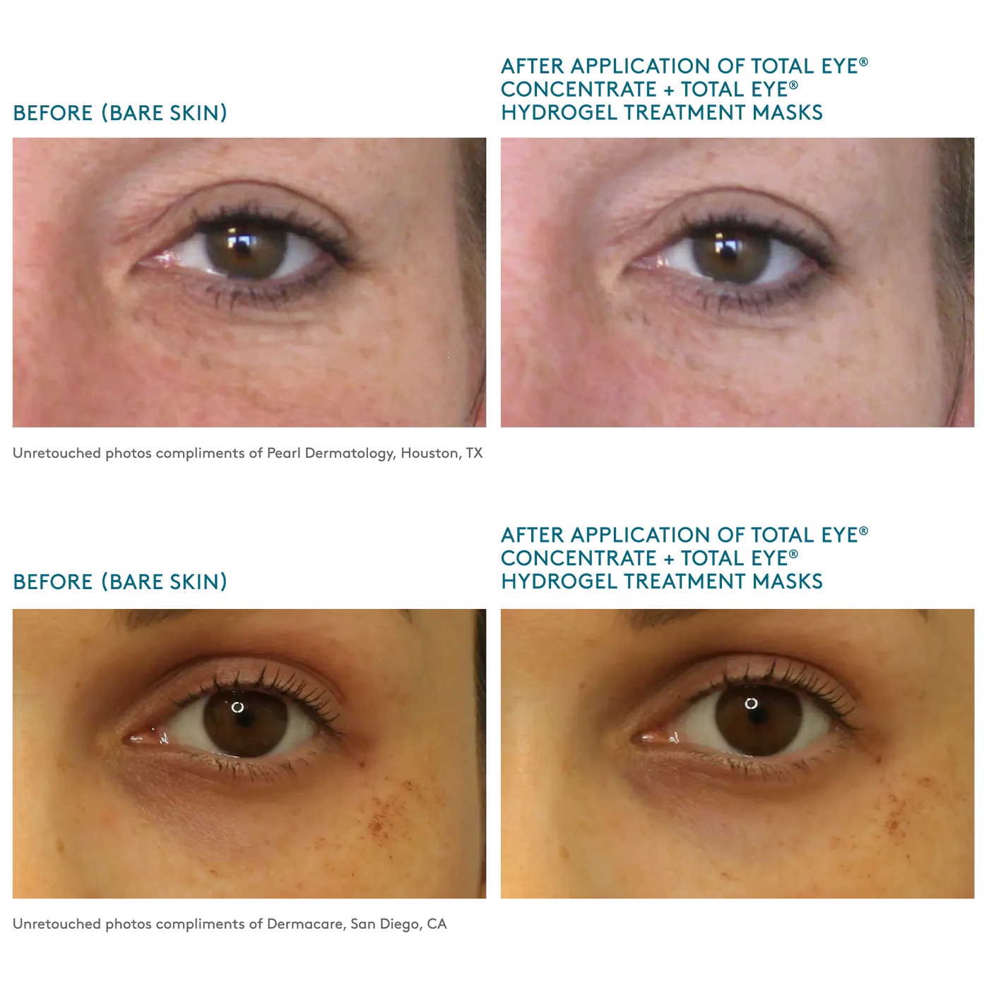 Total Eye® Serum & Hydrogel Masks - Afbeelding 3