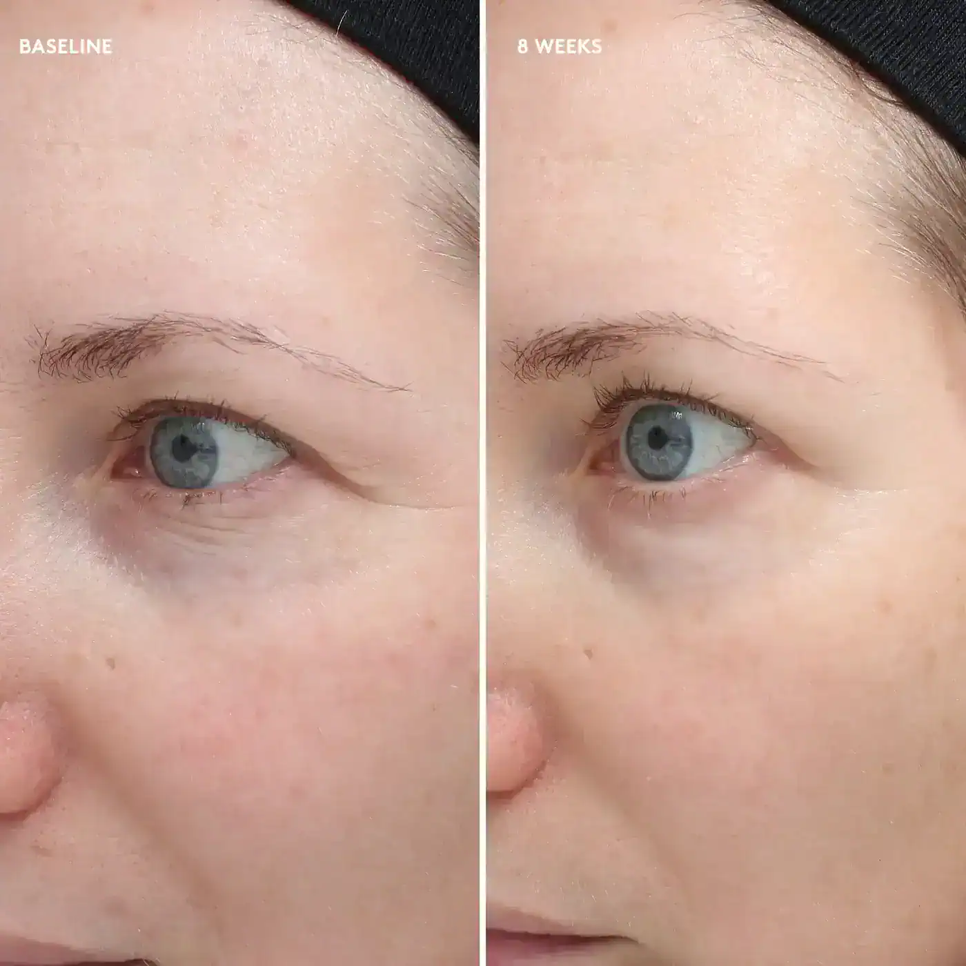 Total Eye Firm & Repair Cream - Image 4